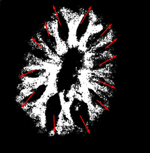 13 Mukhi Indonesian Rudraksha (11-15mm with X-Ray) – Blessings of Lord Kamadeva & Lord Indra for Charm, Success & Prosperity