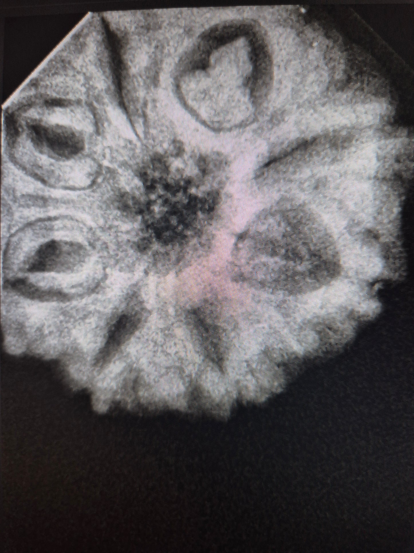 8 Mukhi Indonesian Rudraksha (16mm+) | X-Ray Certified Original Bead