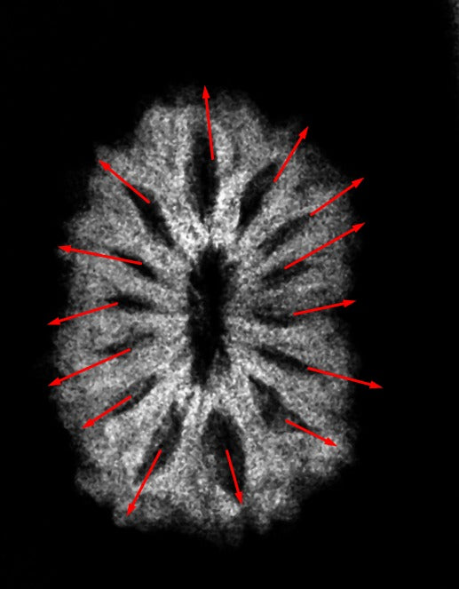 12 Mukhi Indonesian with X-ray